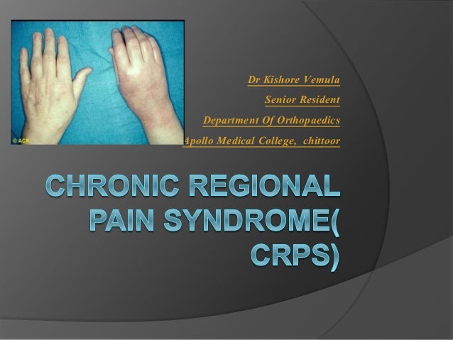 CRPS/ SUDECKS DYSTROPHY & MYOSITIS OSSIFICANS