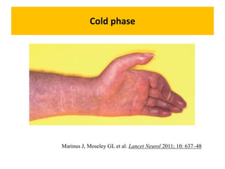Cold phase
Marinus J, Moseley GL et al. Lancet Neurol 2011; 10: 637–48
 