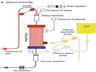 Continuous renal replacement therapy | PPTX