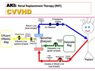 Crrt in aki | PDF