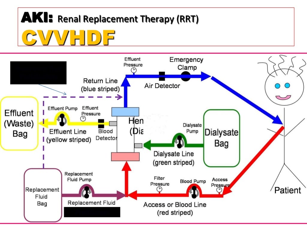 Crrt in aki