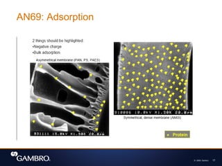 © 2008, Gambro 17
AN69: Adsorption
 