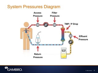 © 2008, Gambro 57
System Pressures Diagram
Access
Pressure
Filter
Pressure
TMP / P Drop
Effluent
Pressure
Return
Pressure
 