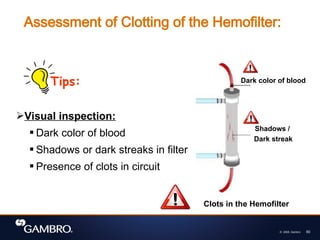 © 2008, Gambro 60
Assessment of Clotting of the Hemofilter:
Dark color of blood
Shadows /
Dark streak
Tips:
Visual inspection:
 Dark color of blood
 Shadows or dark streaks in filter
 Presence of clots in circuit
Clots in the Hemofilter
 
