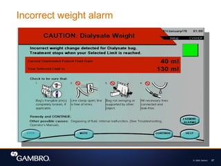 © 2008, Gambro 67
Incorrect weight alarm
 