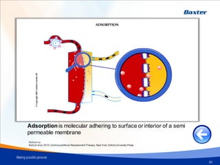 Transport Mechanism - Adsorption
51
Adsorption is molecular adhering to surface or interior of a semi
permeable membrane
Reference:
Kellum et al. 2010.ContinuousRenal Replacement Therapy. New York, Oxford University Press.
 