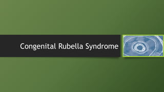 Congenital Rubella Syndrome
 