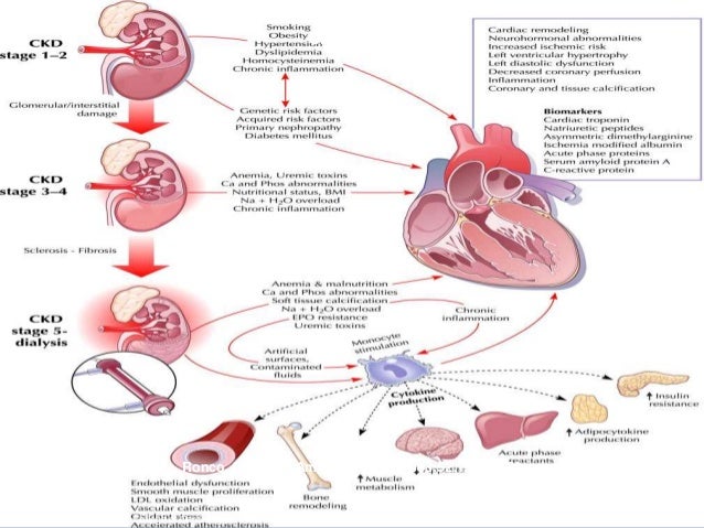 CARDIORENAL SYNDROME