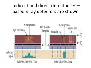 Indirect and direct detector TFT–
based x-ray detectors are shown
25
 