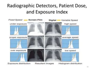 Radiographic Detectors, Patient Dose,
and Exposure Index
33
 