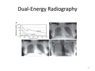 Dual-Energy Radiography
34
 