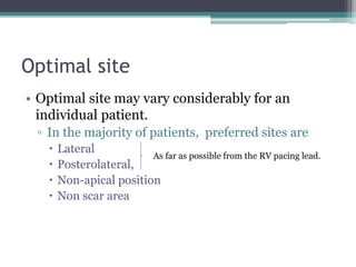 Optimal site
• Optimal site may vary considerably for an
individual patient.
▫ In the majority of patients, preferred sites are
 Lateral
 Posterolateral,
 Non-apical position
 Non scar area
As far as possible from the RV pacing lead.
 