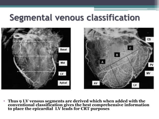 Segmental venous classification
• Thus 9 LV venous segments are derived which when added with the
conventional classification gives the best comprehensive information
to place the epicardial LV leads for CRT purposes
 