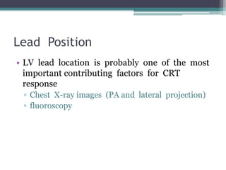 Lead Position
• LV lead location is probably one of the most
important contributing factors for CRT
response
▫ Chest X-ray images (PA and lateral projection)
▫ fluoroscopy
 