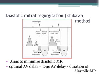 Diastolic mitral regurgitation (Ishikawa)
method
• Aims to minimize diastolic MR.
• optimal AV delay = long AV delay - duration of
diastolic MR
 