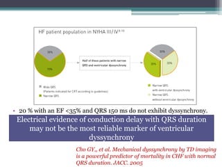 • 20 % with an EF <35% and QRS 150 ms do not exhibit dyssynchrony.
Electrical evidence of conduction delay with QRS duration
may not be the most reliable marker of ventricular
dyssynchrony
Cho GY,, et al. Mechanical dyssynchrony by TD imaging
is a powerful predictor of mortality in CHF with normal
QRS duration. JACC. 2005
 