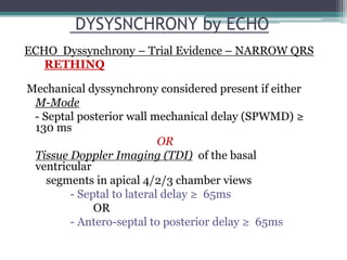 Mechanical dyssynchrony considered present if either
• M-Mode
- Septal posterior wall mechanical delay (SPWMD) ≥
130 ms
OR
• Tissue Doppler Imaging (TDI) of the basal
ventricular
segments in apical 4/2/3 chamber views
- Septal to lateral delay ≥ 65ms
OR
- Antero-septal to posterior delay ≥ 65ms
RETHINQ
DYSYSNCHRONY by ECHO
ECHO Dyssynchrony – Trial Evidence – NARROW QRS
 