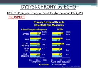 DYSYSNCHRONY by ECHO
PROSPECT
ECHO Dyssynchrony – Trial Evidence – WIDE QRS
 