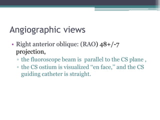 Angiographic views
• Right anterior oblique: (RAO) 48+/-7
projection,
▫ the fluoroscope beam is parallel to the CS plane ,
▫ the CS ostium is visualized ‘‘en face,’’ and the CS
guiding catheter is straight.
 