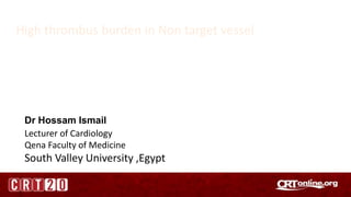 Dr Hossam Ismail
Lecturer of Cardiology
Qena Faculty of Medicine
South Valley University ,Egypt
High thrombus burden in Non target vessel
 