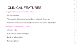 Poliomyelitis - Child Health Nursing | PPTX