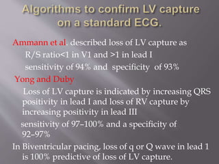 Ammann et al. described loss of LV capture as
R/S ratio<1 in V1 and >1 in lead I
sensitivity of 94% and speciﬁcity of 93%
Yong and Duby
Loss of LV capture is indicated by increasing QRS
positivity in lead I and loss of RV capture by
increasing positivity in lead III
sensitivity of 97–100% and a speciﬁcity of
92–97%
In Biventricular pacing, loss of q or Q wave in lead 1
is 100% predictive of loss of LV capture.
 