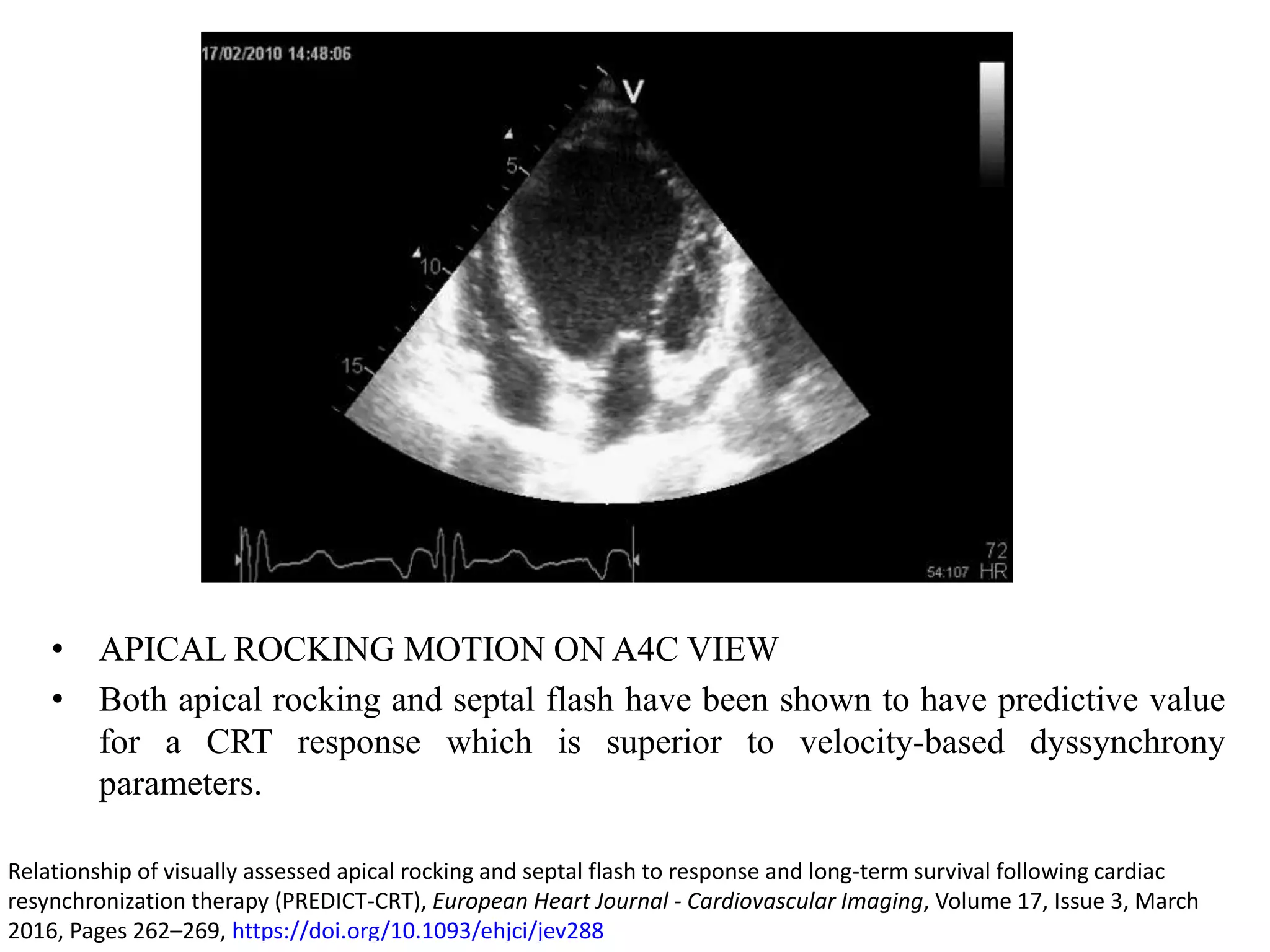 Crt responders vs non responders | PPTX