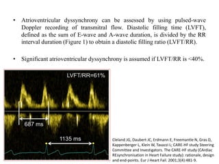 • Atrioventricular dyssynchrony can be assessed by using pulsed-wave
Doppler recording of transmitral flow. Diastolic filling time (LVFT),
defined as the sum of E-wave and A-wave duration, is divided by the RR
interval duration (Figure 1) to obtain a diastolic filling ratio (LVFT/RR).
• Significant atrioventricular dyssynchrony is assumed if LVFT/RR is <40%.
Cleland JG, Daubert JC, Erdmann E, Freemantle N, Gras D,
Kappenberger L, Klein W, Tavazzi L; CARE-HF study Steering
Committee and Investigators. The CARE-HF study (CArdiac
REsynchronisation in Heart Failure study): rationale, design
and end-points. Eur J Heart Fail. 2001;3(4):481-9.
 