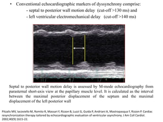 • Conventional echocardiographic markers of dyssynchrony comprise:
- septal to posterior wall motion delay (cut-off >130 ms) and
- left ventricular electromechanical delay (cut-off >140 ms)
Septal to posterior wall motion delay is assessed by M-mode echocardiography from
parasternal short-axis view at the papillary muscle level. It is calculated as the interval
between the maximal posterior displacement of the septum and the maximal
displacement of the left posterior wall
Pitzalis MV, Iacoviello M, Romito R, Massari F, Rizzon B, Luzzi G, Guida P, Andriani A, Mastropasqua F, Rizzon P. Cardiac
resynchronization therapy tailored by echocardiographic evaluation of ventricular asynchrony. J Am Coll Cardiol.
2002;40(9):1615-22.
 