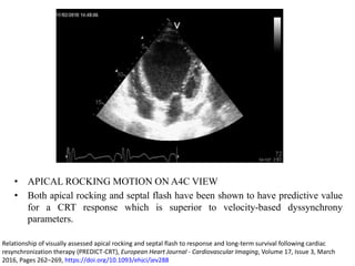 • APICAL ROCKING MOTION ON A4C VIEW
• Both apical rocking and septal flash have been shown to have predictive value
for a CRT response which is superior to velocity-based dyssynchrony
parameters.
Relationship of visually assessed apical rocking and septal flash to response and long-term survival following cardiac
resynchronization therapy (PREDICT-CRT), European Heart Journal - Cardiovascular Imaging, Volume 17, Issue 3, March
2016, Pages 262–269, https://doi.org/10.1093/ehjci/jev288
 