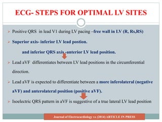 ECG- STEPS FOR OPTIMAL LV SITES
 Positive QRS in lead V1 during LV pacing –free wall in LV (R, Rs,RS)
 Superior axis- inferior LV lead postion.
and inferior QRS axis -anterior LV lead position.
 Lead aVF differentiates between LV lead positions in the circumferential
direction.
 Lead aVF is expected to differentiate between a more inferolateral (negative
aVF) and anterolateral position (positive aVF).
 Isoelectric QRS pattern in aVF is suggestive of a true lateral LV lead position
Journal of Electrocardiology xx (2014) ARTICLE IN PRESS
 
