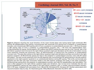 Cardiology Journal 2011, Vol. 18, No. 5
RV APEX- LEFT INFERIOR
RVOT-RIGHT INFERIOR
LV-RIGHT INFERIOR
RVA + LV –RIGHT
SUPERIOR
RVOT+ LV- RIGHT
INFERIOR
 