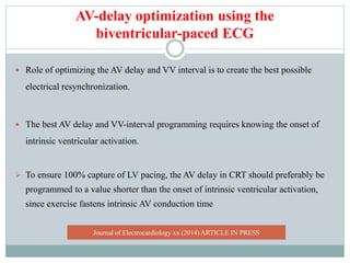 AV-delay optimization using the
biventricular-paced ECG
 Role of optimizing the AV delay and VV interval is to create the best possible
electrical resynchronization.
 The best AV delay and VV-interval programming requires knowing the onset of
intrinsic ventricular activation.
 To ensure 100% capture of LV pacing, the AV delay in CRT should preferably be
programmed to a value shorter than the onset of intrinsic ventricular activation,
since exercise fastens intrinsic AV conduction time
Journal of Electrocardiology xx (2014) ARTICLE IN PRESS
 