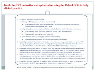 Guide for CRT evaluation and optimization using the 12-lead ECG in daily
clinical practice
 