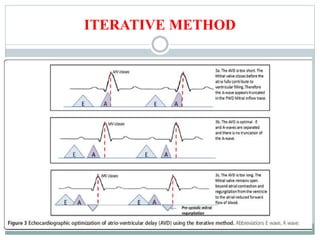 ITERATIVE METHOD
 