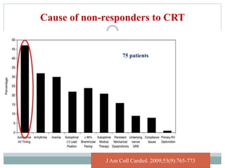 Cause of non-responders to CRT
J Am Coll Cardiol. 2009;53(9):765-773
75 patients
 