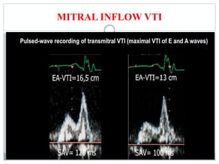 MITRAL INFLOW VTI
 