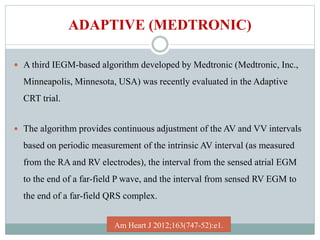 ADAPTIVE (MEDTRONIC)
 A third IEGM-based algorithm developed by Medtronic (Medtronic, Inc.,
Minneapolis, Minnesota, USA) was recently evaluated in the Adaptive
CRT trial.
 The algorithm provides continuous adjustment of the AV and VV intervals
based on periodic measurement of the intrinsic AV interval (as measured
from the RA and RV electrodes), the interval from the sensed atrial EGM
to the end of a far-field P wave, and the interval from sensed RV EGM to
the end of a far-field QRS complex.
Am Heart J 2012;163(747-52):e1.
 