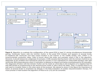 POST CRT OPTIMISATION