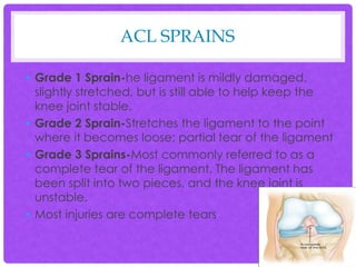 Anterior/Posterior Cruciate ligaments by Shannon Davis | PPTX