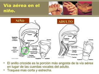 Vía aérea en el
niño.

        NIÑO                          ADULTO




• El anillo cricoide es la porción más angosta de la vía aérea
  en lugar de las cuerdas vocales del adulto.
• Traquea mas corta y estrecha.
 