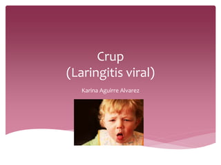 Crup
(Laringitis viral)
Karina Aguirre Alvarez
 