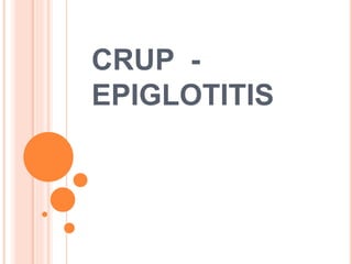CRUP -
EPIGLOTITIS
 