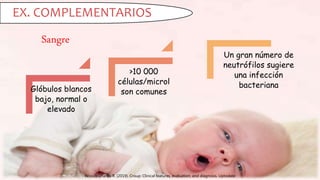 Woods Charles R. (2019). Croup: Clinical features, evaluation, and diagnosis. Uptodate
EX. COMPLEMENTARIOS
Sangre
Glóbulos blancos
bajo, normal o
elevado
>10 000
células/microl
son comunes
Un gran número de
neutrófilos sugiere
una infección
bacteriana
 
