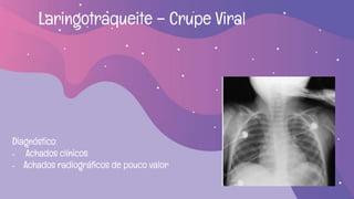 Laringotraqueite – Crupe Viral
Diagnóstico:
- Achados clínicos
- Achados radiográficos de pouco valor
 