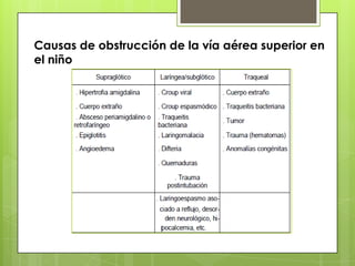Causas de obstrucción de la vía aérea superior en
el niño

 