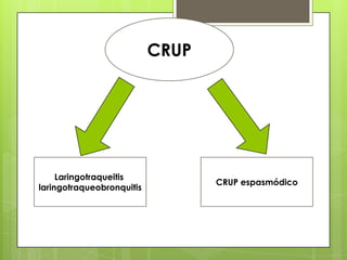 CRUP

Laringotraqueitis
laringotraqueobronquitis

CRUP espasmódico

 