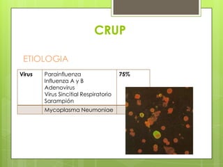 CRUP
ETIOLOGIA
Virus

Parainfluenza
Influenza A y B
Adenovirus
Virus Sincitial Respiratorio
Sarampión
Mycoplasma Neumoniae

75%

 