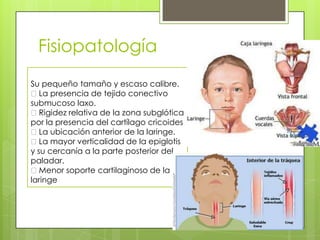 Fisiopatología
Su pequeño tamaño y escaso calibre.
La presencia de tejido conectivo
submucoso laxo.
Rigidez relativa de la zona subglótica
por la presencia del cartílago cricoides
La ubicación anterior de la laringe.
La mayor verticalidad de la epiglotis
y su cercanía a la parte posterior del
paladar.
Menor soporte cartilaginoso de la
laringe

 