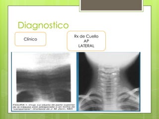 Diagnostico
Clínico

Rx de Cuello
AP
LATERAL

 